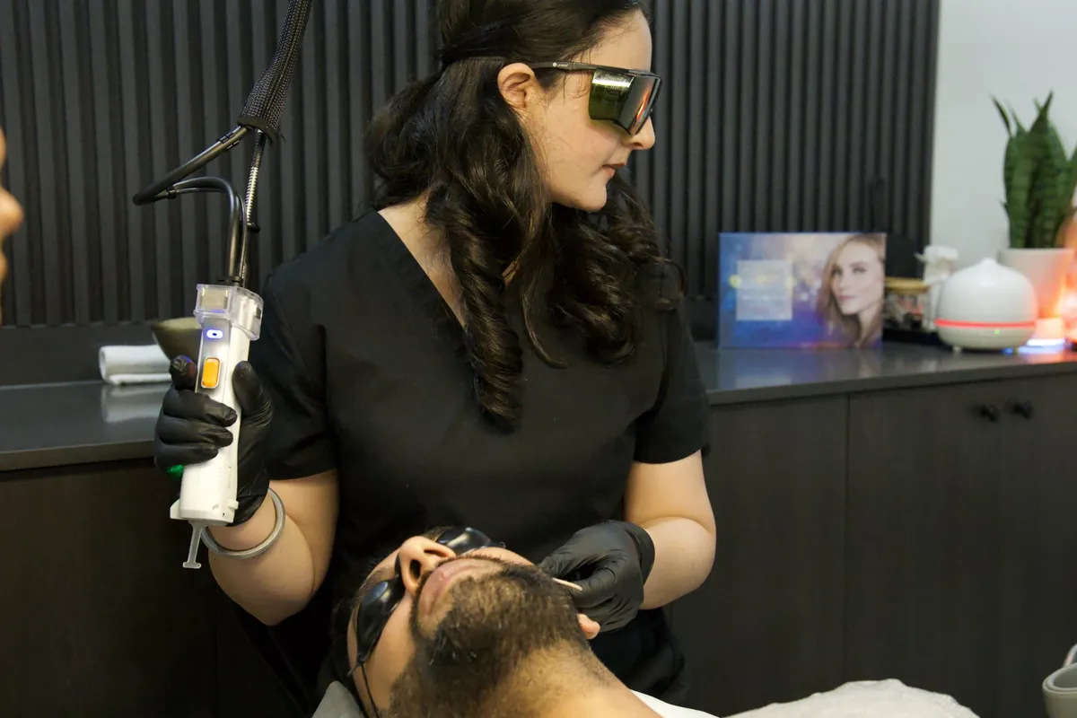A Skinholic laser technician treating a client’s beard line.